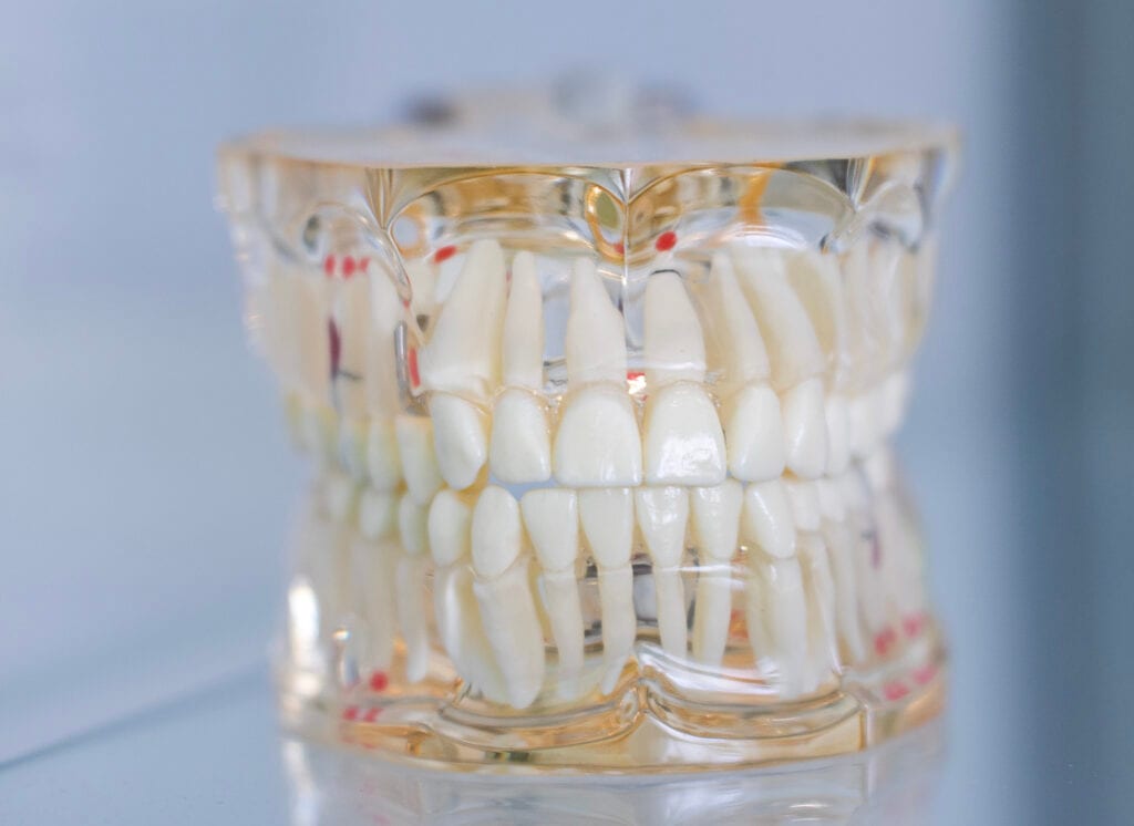 Patientin beim Zahnarzt mit Lachgassedierung.