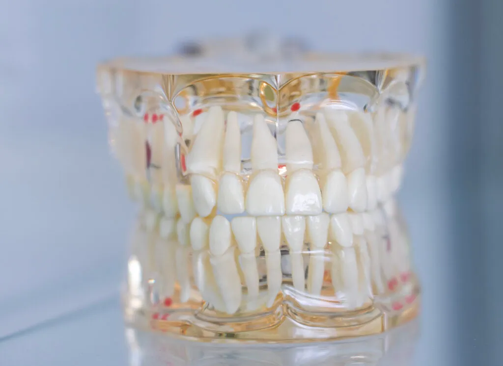 Patientin beim Zahnarzt mit Lachgassedierung.